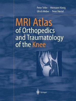 MRI Atlas of Orthopedics and Traumatology of the Knee 1