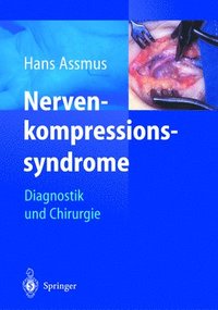 bokomslag Nerven-kompressions-syndrome