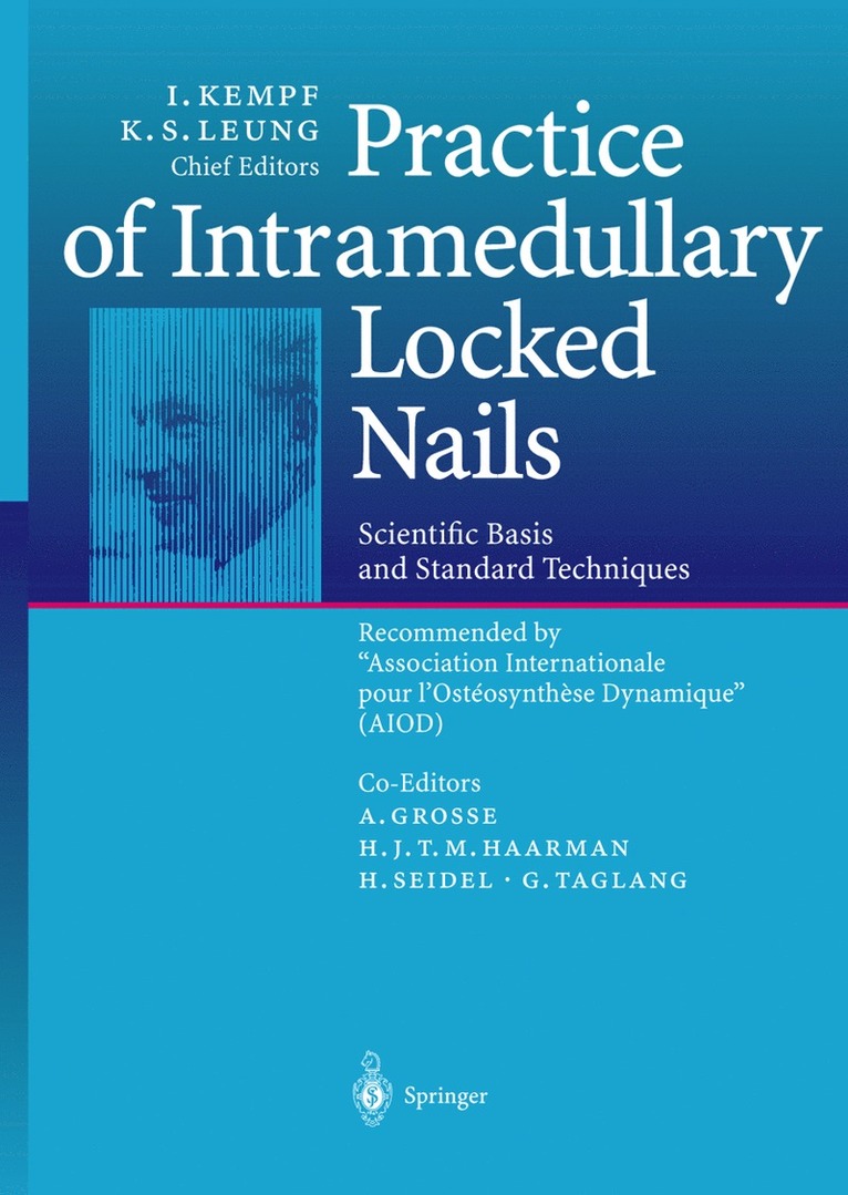I. Kempf, K.S. Leung, K. S. Leung - Practice of Intramedullary Locked Nails, Häftad
