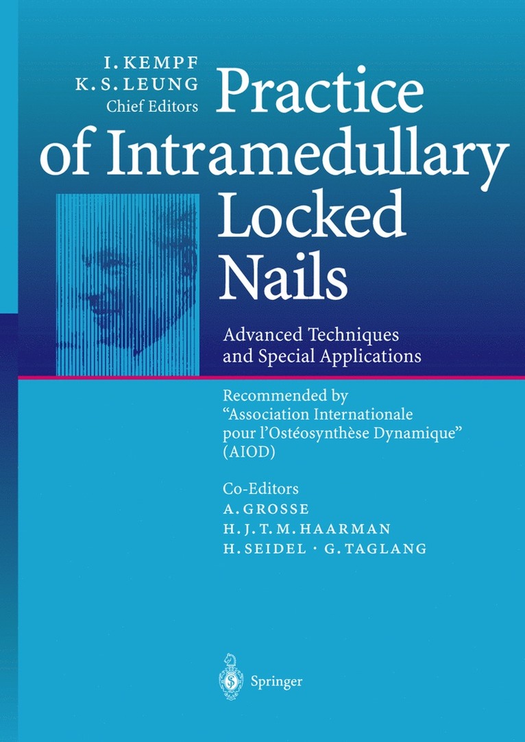 I. Kempf, K.S. Leung, K. S. Leung - Practice of Intramedullary Locked Nails, Häftad