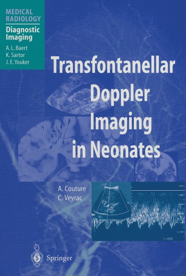 bokomslag Transfontanellar Doppler Imaging in Neonates