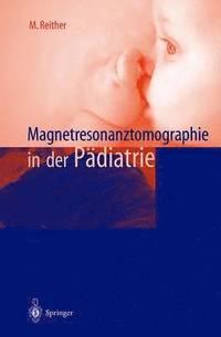 bokomslag Magnetresonanztomographie in der Pdiatrie