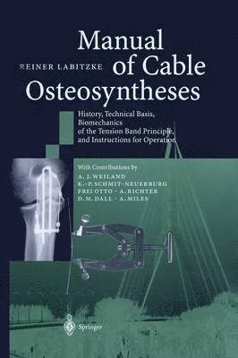 bokomslag Manual of Cable Osteosyntheses