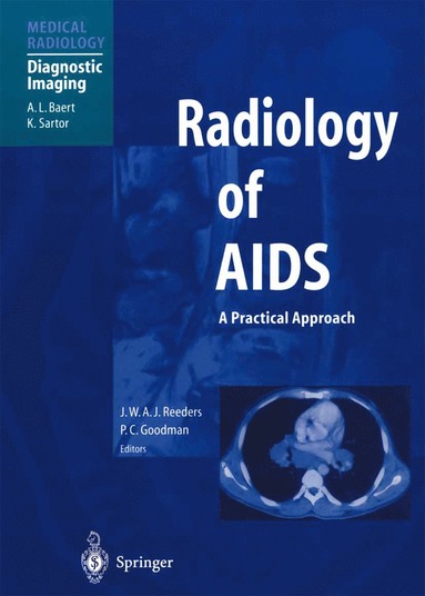 bokomslag Radiology of AIDS