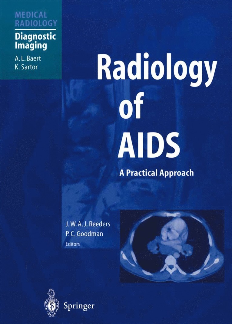 Radiology of AIDS 1