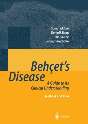 Behets Disease 1