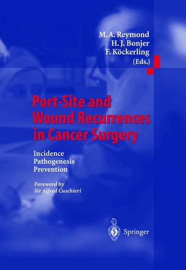 M.A. Reymond, H.J. Bonjer, F. Köckerling - Port-Site and Wound Recurrences in Cancer Surgery, Häftad