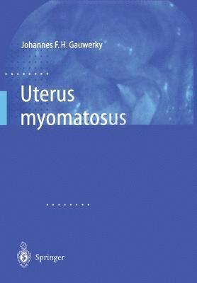 bokomslag Uterus myomatosus