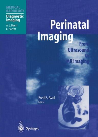 bokomslag Perinatal Imaging