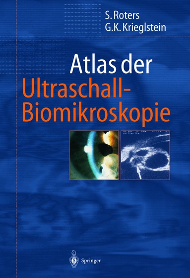 Sigrid Roters, Günter K. Krieglstein - Atlas der Ultraschall-Biomikroskopie, Häftad