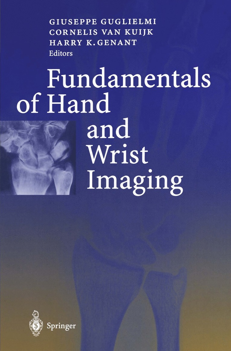 G. Guglielmi, C. van Kuijk, H.K. Genant, C. Van Kuijk, H. K. Genant - Fundamentals of Hand and Wrist Imaging, Häftad