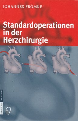 bokomslag Standardoperationen in der Herzchirurgie