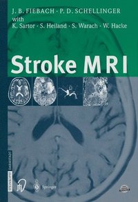 bokomslag Stroke MRI