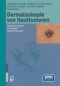 bokomslag Dermatoskopie von Hauttumoren