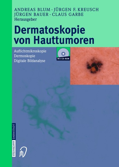 A. Blum, J.F. Kreusch, J. Bauer, C. Garbe - Dermatoskopie von Hauttumoren, Häftad