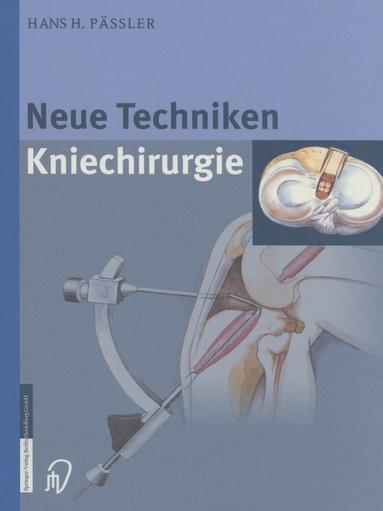 bokomslag Neue Techniken Kniechirurgie