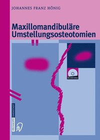 bokomslag Maxillomandibulre Umstellungsosteotomien