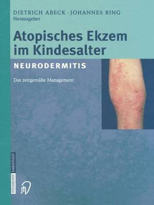 bokomslag Atopisches Ekzem im Kindesalter (Neurodermitis)