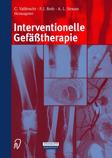 C. Vallbracht, F.-J. Roth, A.L. Strauss - Interventionelle Gefäßtherapie, Häftad