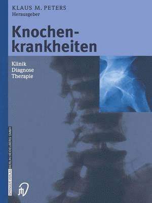 Klaus M. Peters - Knochenkrankheiten, Häftad