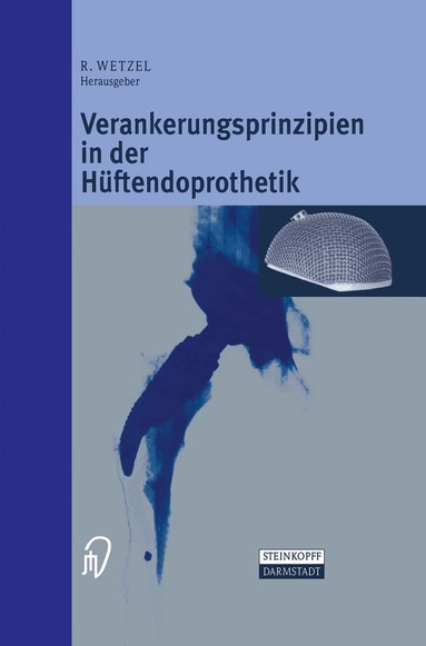 Roland Wetzel - Verankerungsprinzipien in der Hüftendoprothetik, Häftad