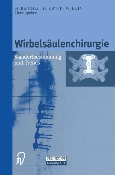 H. Reichel, H. Zwipp, W. Hein - Wirbelsäulenchirurgie, Häftad