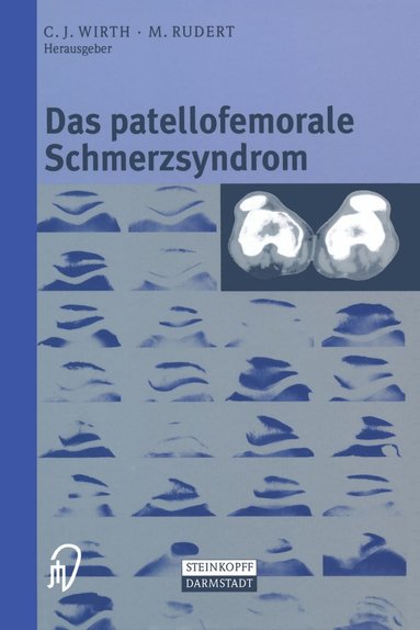 bokomslag Das patellofemorale Schmerzsyndrom