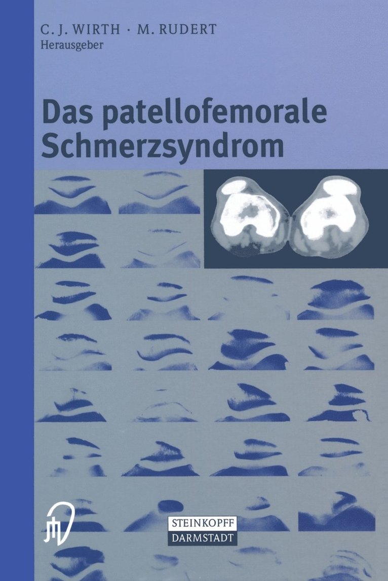 C.J. Wirth, M. Rudert, C. J. Wirth - Das patellofemorale Schmerzsyndrom, Häftad