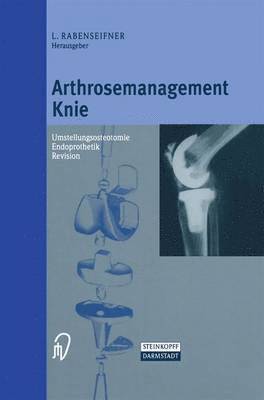 Arthrosemanagement Knie 1