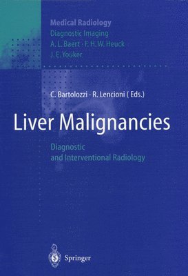 Liver Malignancies 1