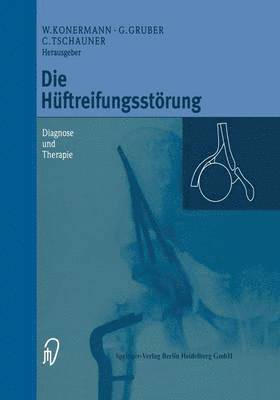 Die Hüftreifungsstörung