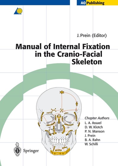 Joachim Prein - Manual of Internal Fixation in the Cranio-Facial Skeleton, Häftad