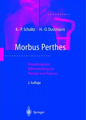 Klaus-Peter Schulitz, Hans-Otto Dustmann - Morbus Perthes, Häftad