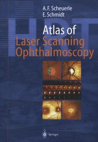 bokomslag Atlas of Laser Scanning Ophthalmoscopy