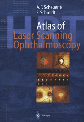 Atlas of Laser Scanning Ophthalmoscopy 1