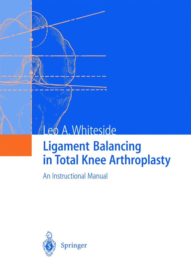 Ligament Balancing in Total Knee Arthroplasty
