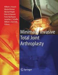 bokomslag Minimally Invasive Total Joint Arthroplasty