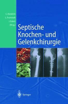 bokomslag Septische Knochen-und Gelenkchirurgie