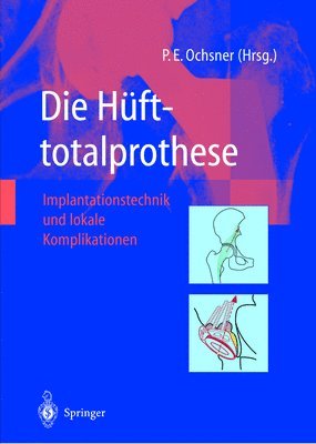 Die Hfttotalprothese 1