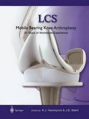 LCS Mobile Bearing Knee Arthroplasty 1