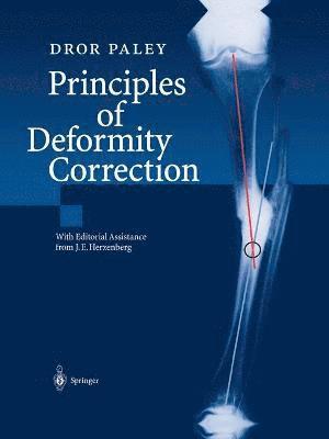 bokomslag Principles of Deformity Correction