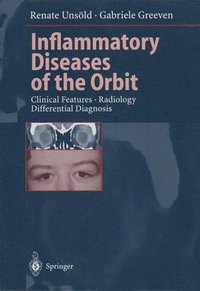 bokomslag Inflammatory Diseases of the Orbit