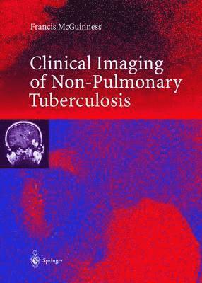 bokomslag Clinical Imaging in Non-Pulmonary Tuberculosis