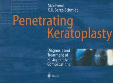 bokomslag Penetrating Keratoplasty