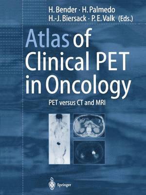 Atlas of Clinical PET in Oncology 1