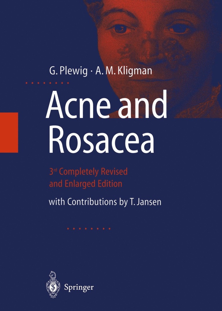 G. Plewig, A.M. Kligman, A. M. Kligman - ACNE and ROSACEA, Häftad
