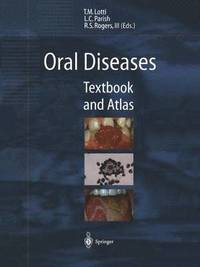bokomslag Oral Diseases
