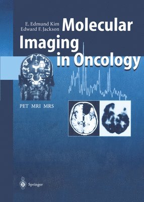 bokomslag Molecular Imaging in Oncology