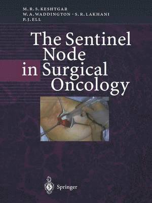 bokomslag The Sentinel Node in Surgical Oncology