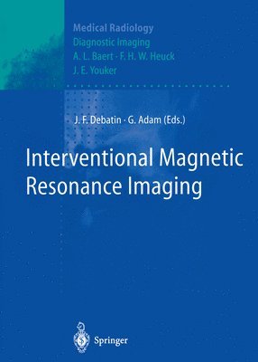 Interventional Magnetic Resonance Imaging 1